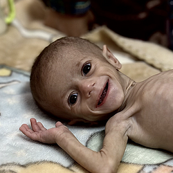 FEED GAZA मूल्य का पूर्वानुमान